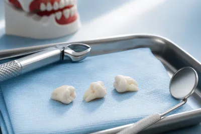 How Much Does Wisdom Tooth Removal Cost?