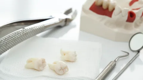 How Much Does Wisdom Tooth Removal Cost?