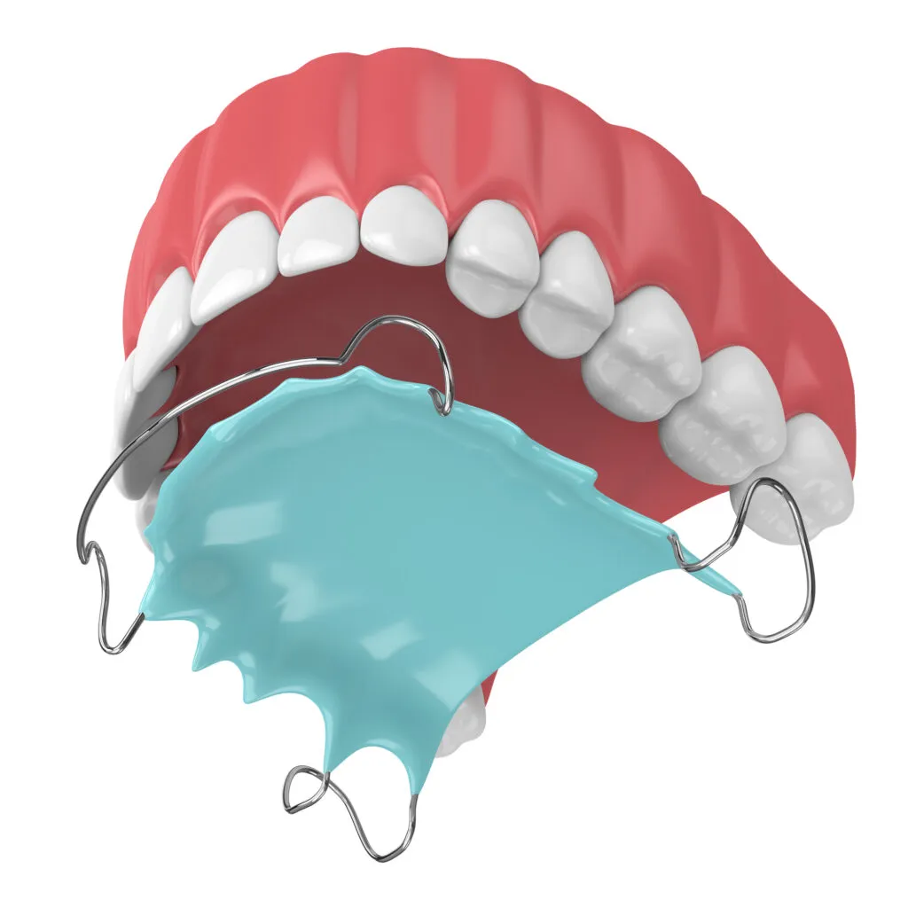 3D render of a tongue crib applicance