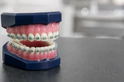 Bite Blocks for Braces