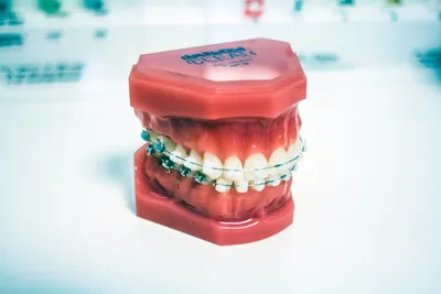 Bite Blocks for Braces