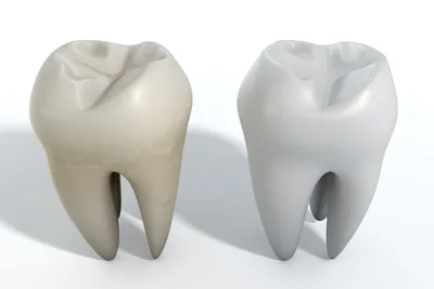 How to Deal with Intrinsic Tooth Stains