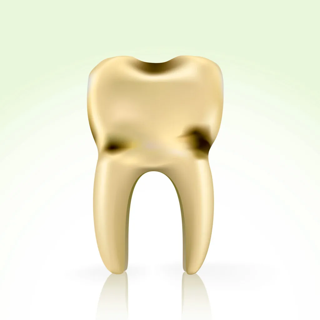 Black spots on tooth 3d illustration