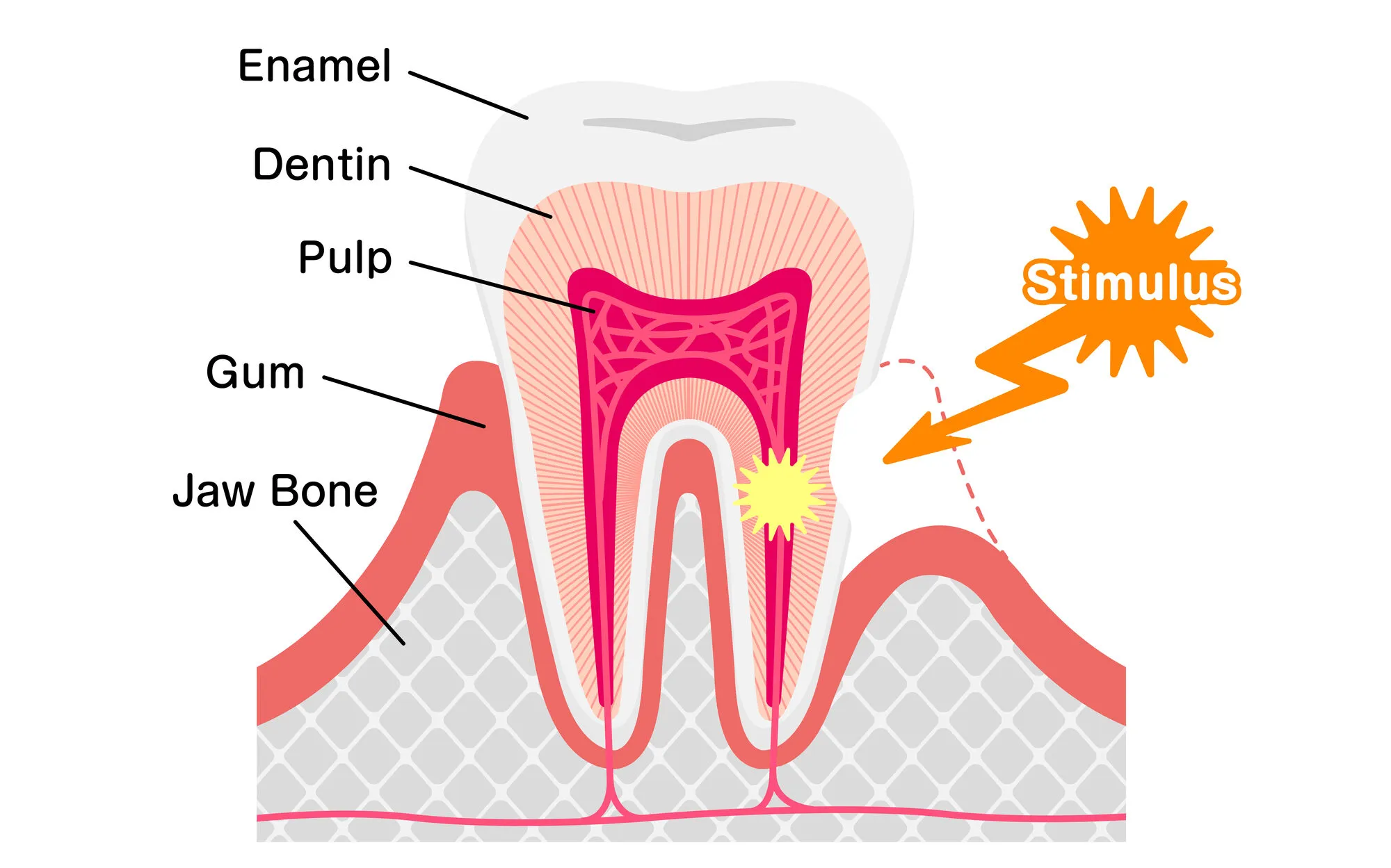 Cause and mechanism of Sensitive teeth vector illustration edited