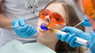 How Much Does a Filling Cost Without Insurance?