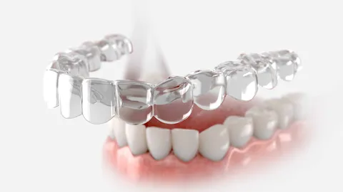 Diamond Whites Aligners Review (2026)