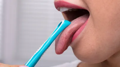 The Best Tongue Scrapers for Fresher Breath &amp; Improved Health