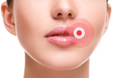 Stomatitis: Causes, Symptoms, and How to Treat Mouth Inflammation