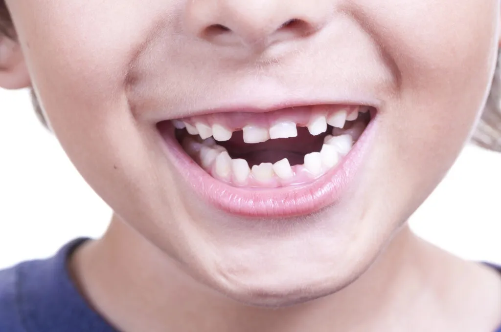 Cropped shot of a smiling little boy showing his baby teeth