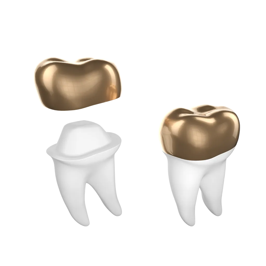 Dental Crown Gold