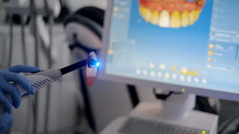 What Is CEREC in Dentistry? (Procedure, Pros & Cons)