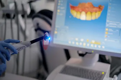 What Is CEREC in Dentistry? (Procedure, Pros & Cons)