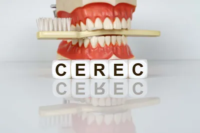 What are Same-Day CEREC Crowns?