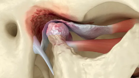 TMJ Surgery: Types, Costs, What to Expect, Procedure, and Recovery