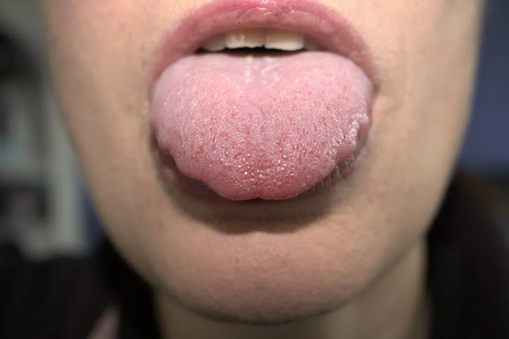 Close-up of a person sticking out their tongue, showing its texture and pink color.