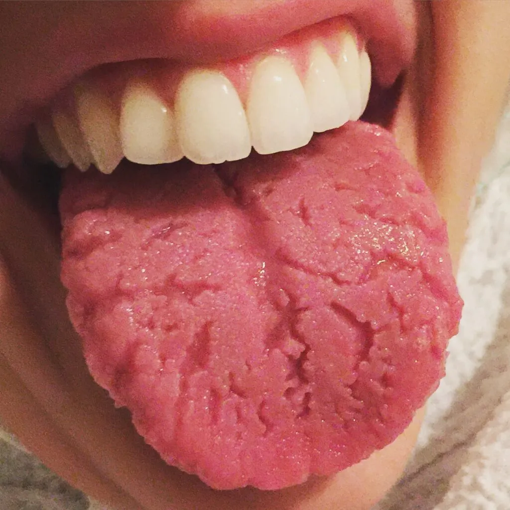 Close-up of a person with their mouth open, showing their upper teeth and extended tongue. The tongue appears pink and textured.