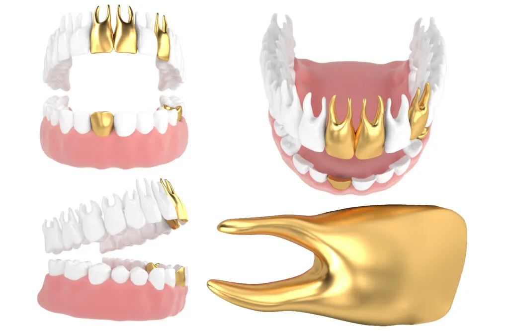 Gold grills 3d render