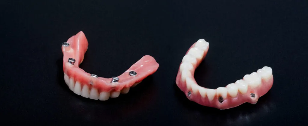 Hybrid dentures pictured on black background