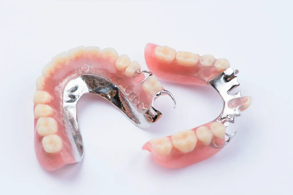 Removable metal partial denture on white background