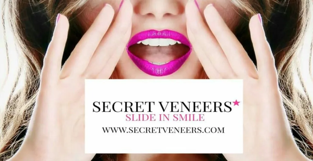 Secret Veneers logo