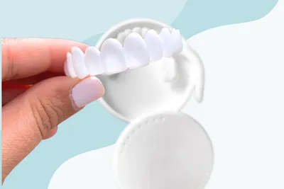 Secret Veneers Review (2026)