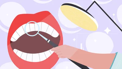 7 Best Snap-On Veneers (2026)