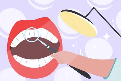 7 Best Snap-On Veneers