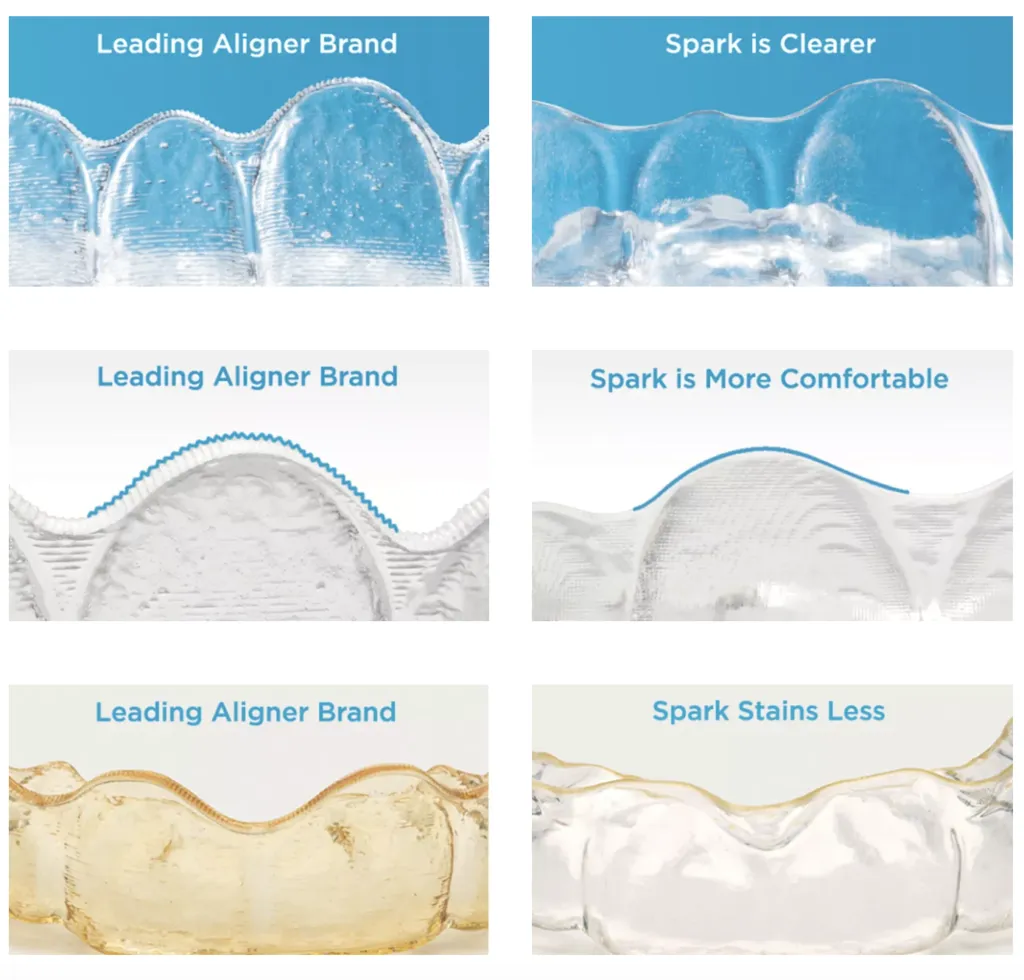 Spark aligners website screenshot