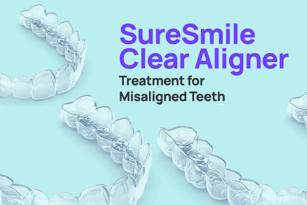 SureSmile Clear Aligner Treatment for Misaligned Teeth 2