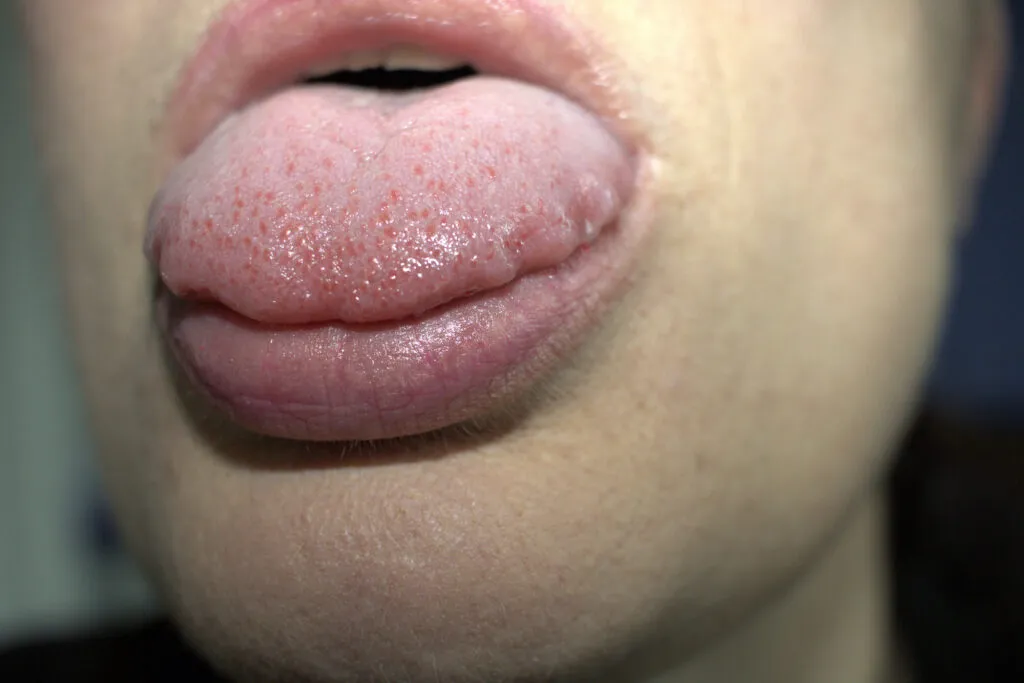 Close-up of a person sticking out their tongue and slightly pursing their lips.