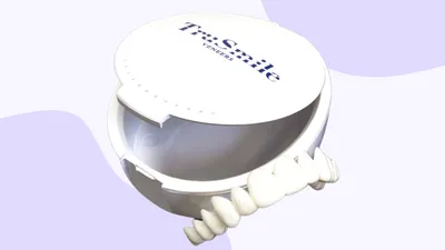 Trusmile Snap On Veneers Review (2026)