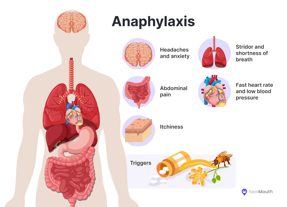 Anaphylaxis