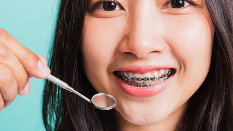 How to Get Free Braces with Medicaid