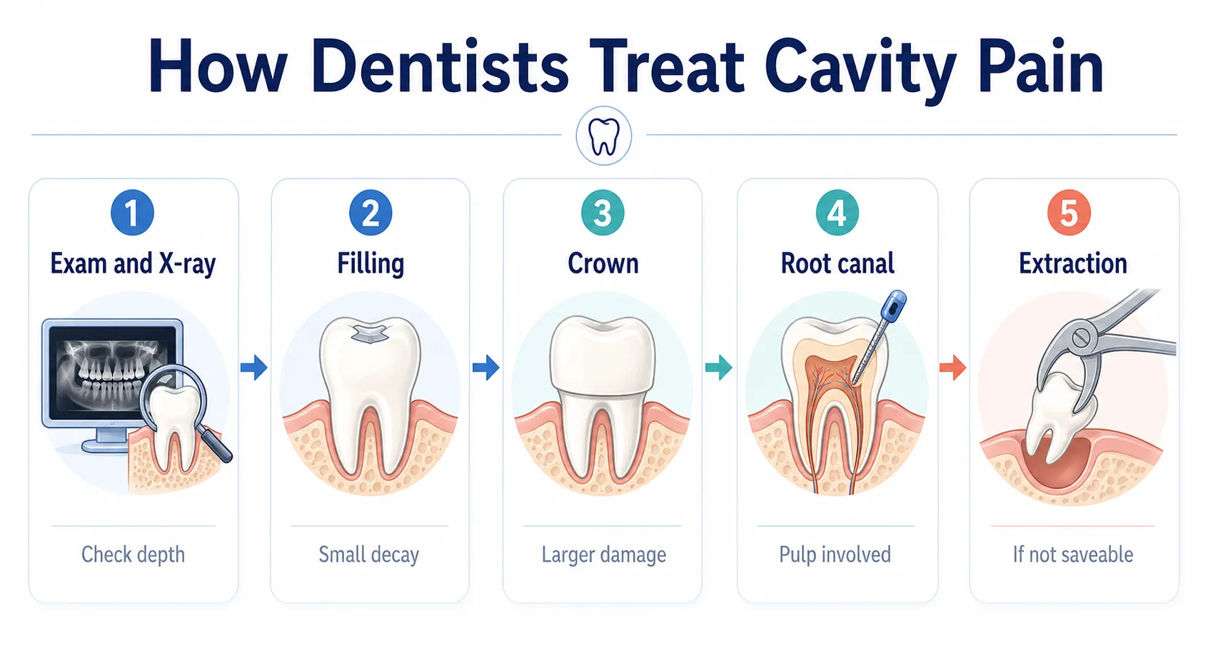Cavity pain treatment options board v1