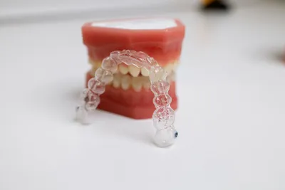 How Much Do Clear Aligners Cost?