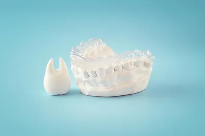 Can Invisalign Fix Underbite?
