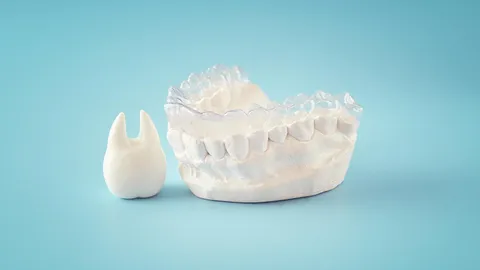 Can Invisalign Fix Underbite?