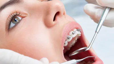 How Long Do Braces Hurt?