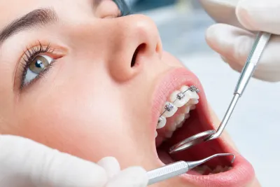 How Long Do Braces Hurt?