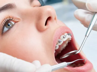 How Long Do Braces Hurt?