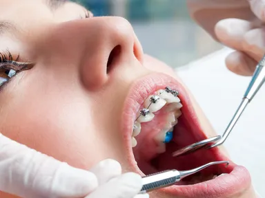 How Long Do Braces Hurt?