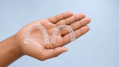 Invisalign for Top or Bottom Teeth Only