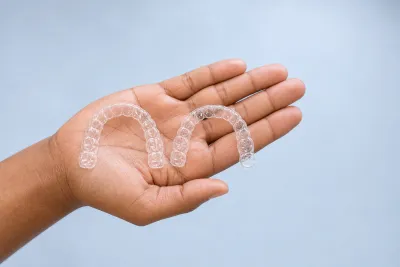 Invisalign for Top or Bottom Teeth Only