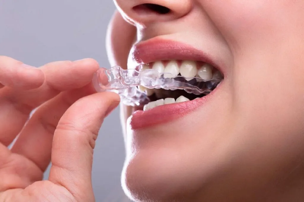 Close up of person putting on clear aligner