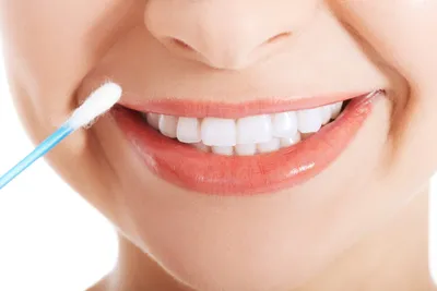 Teeth Whitening Swabs: Pros, Cons, and Cost