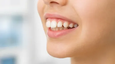 Buck Teeth