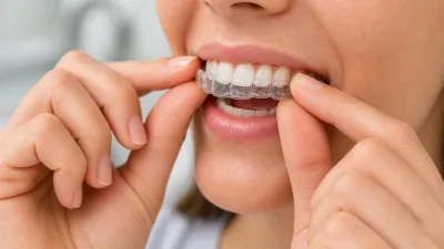 How Can You Remove a Tight Retainer Safely?