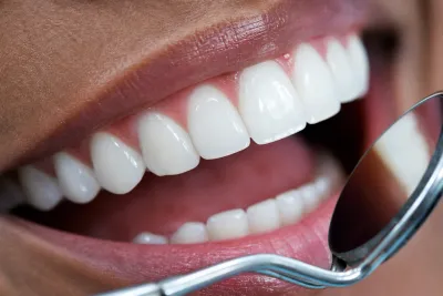 Types of Teeth: Their Shapes, Functions, and How to Change Them