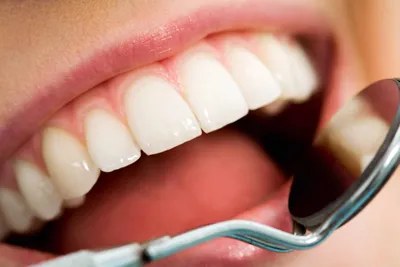 Types of Teeth: Their Shapes, Functions, and How to Change Them