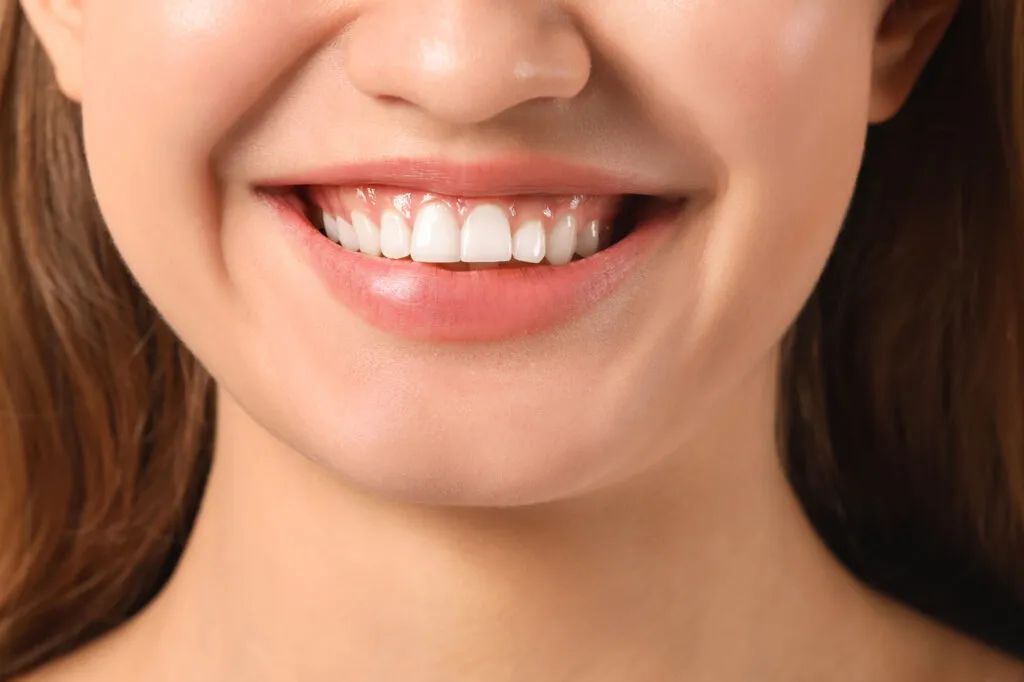 Close up shot of a young woman with healthy gums